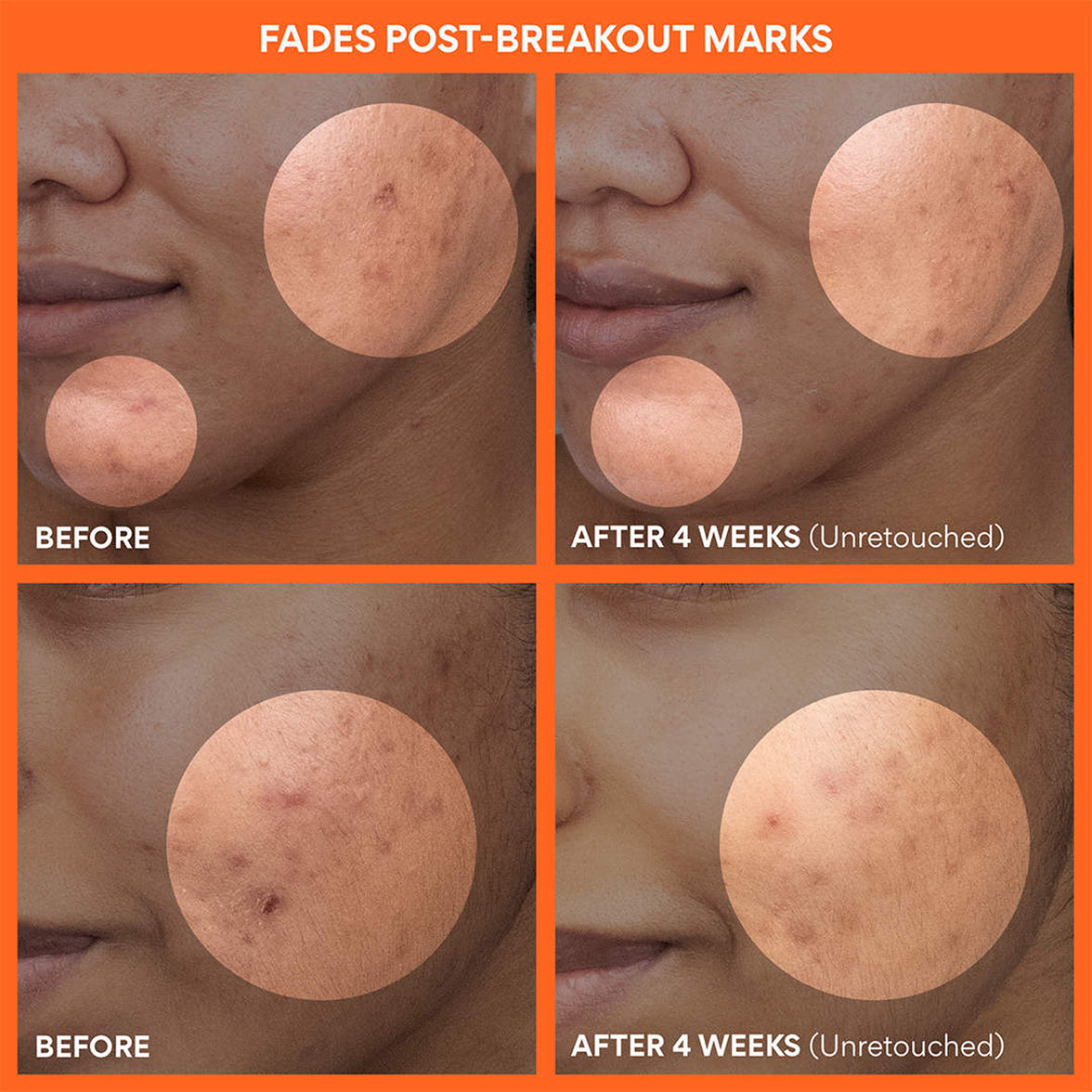 Vitamin C Brightening Toner Pad