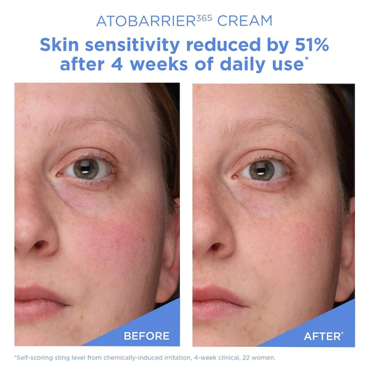 Ceramides Cream Moisturizer